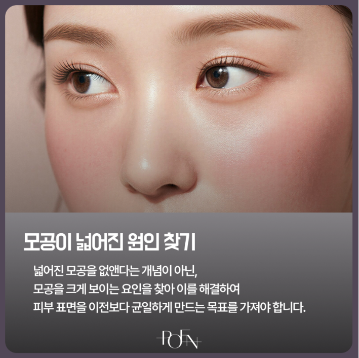 스크린샷 2026-09-18 142110 - 강남 피부과 포엔의원 / POEN Clinic / POEN皮膚科 / POEN クリニック